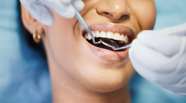 Best Emergency Broken Tooth Repair in Hometown, IL