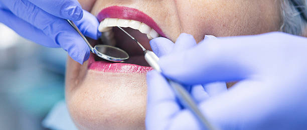 Best Emergency Treatment for Toothache in Hometown, IL